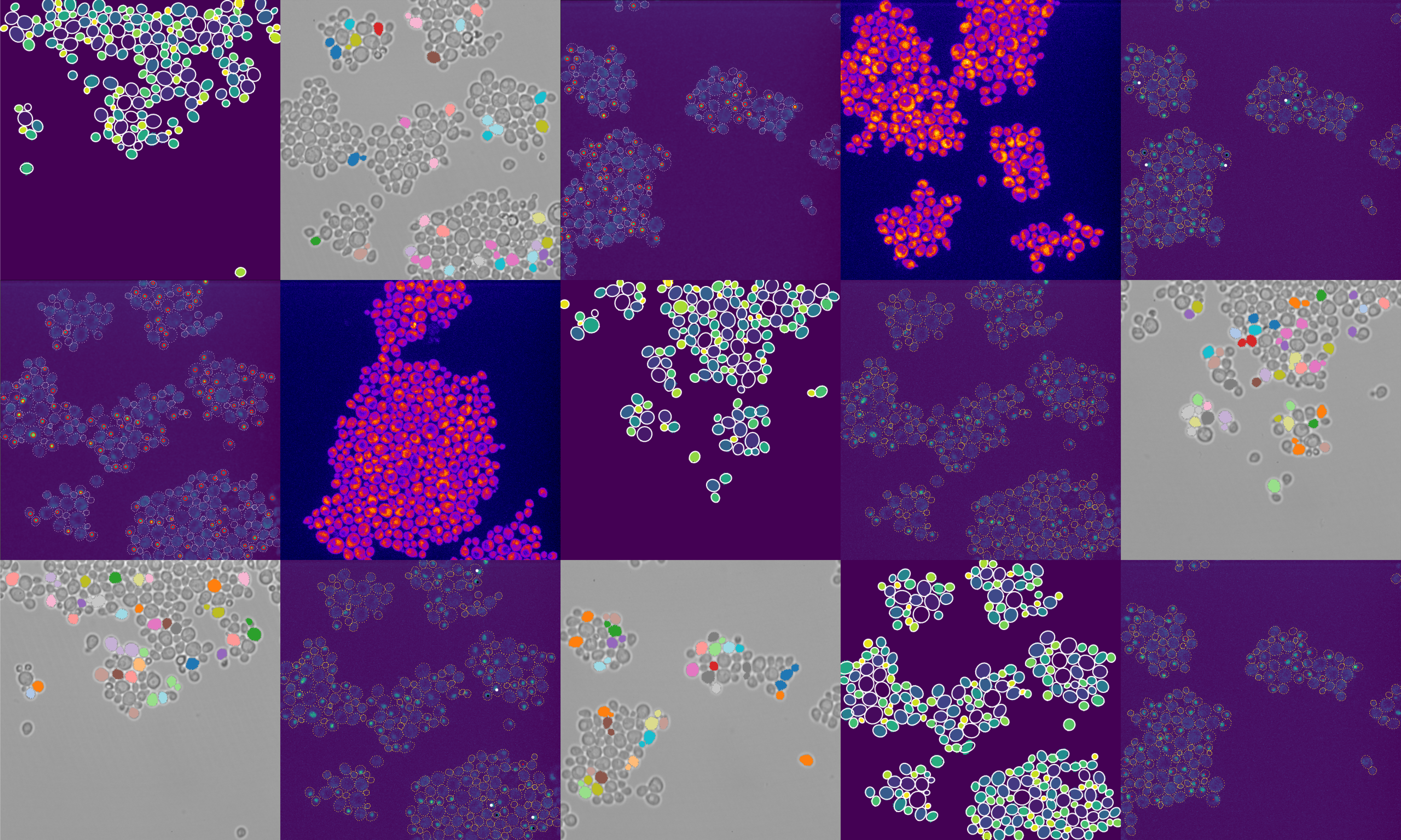 Budding yeast image processing